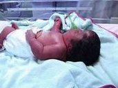 确诊为免疫性不孕能在青州市做试管婴儿吗？做三代试管需要多少钱？